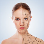 dry skin v. hydrated skin