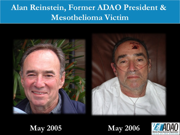 Alan Reinstein, founder of ADAO