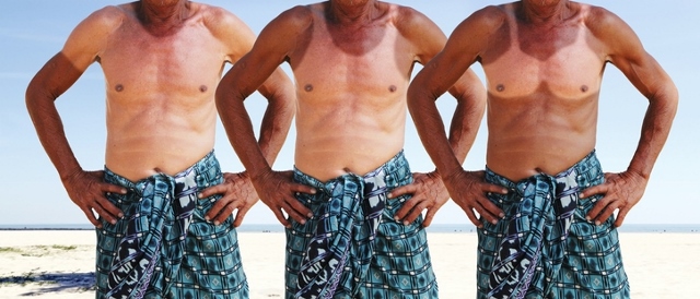 funny man with sunburn in summer beach